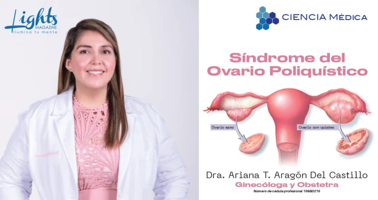 síndrome ovario poliquístico